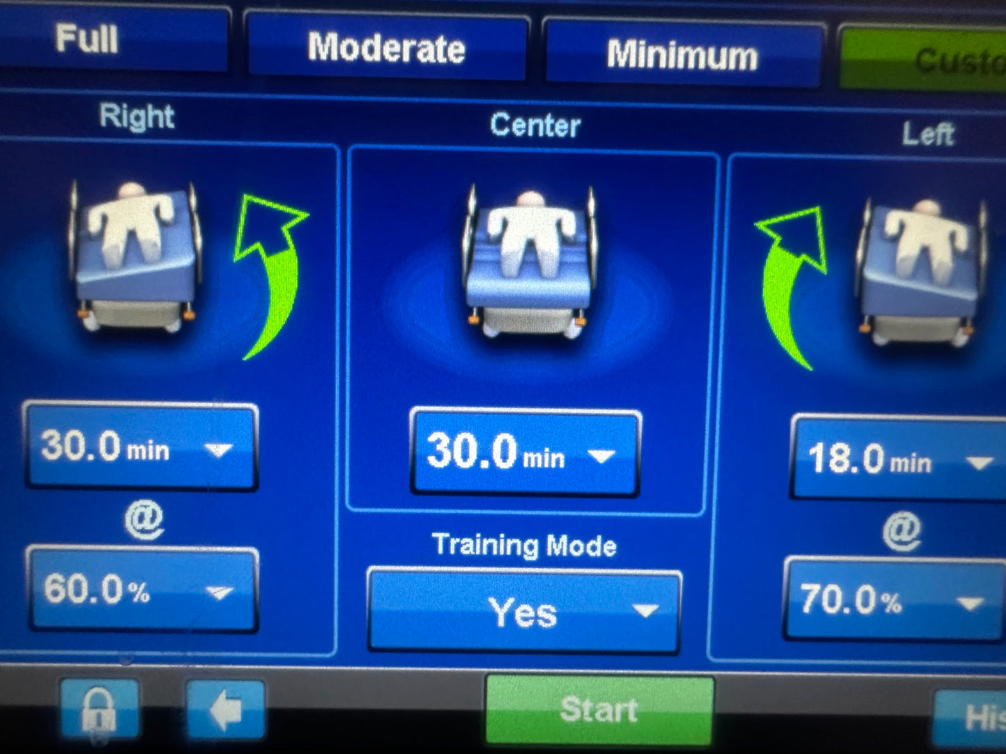 Hill Rom P7500 Progressa Bed WITHOUT PERCUSSION FEATURE